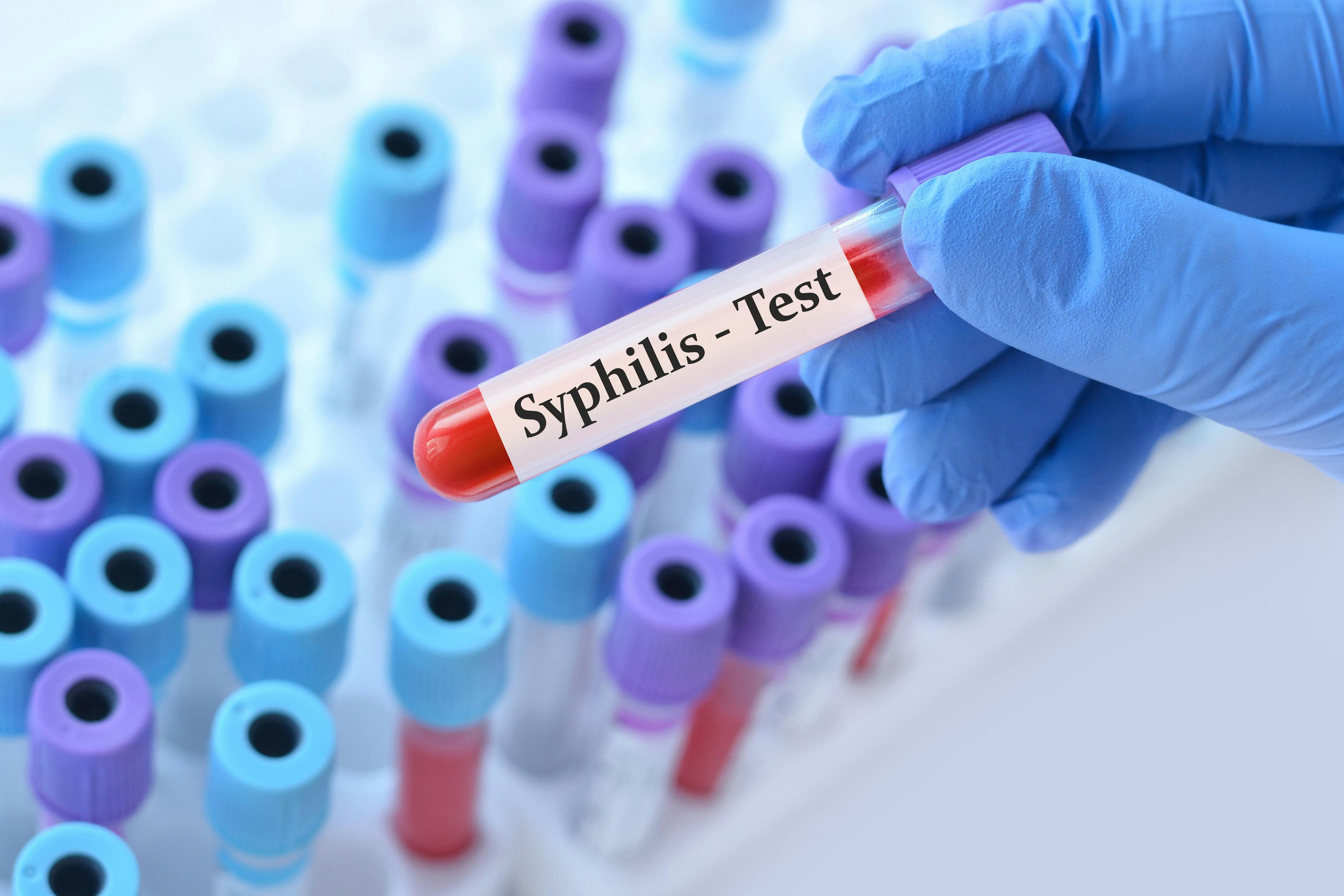 Link found between delayed prenatal care and congenital syphilis rates | Image Credit: © Jsyhin_stas - © syhin_stas - stock.adobe.com.Link found between delayed prenatal care and congenital syphilis rates | Image Credit: © Jsyhin_stas - © syhin_stas - stock.adobe.com.