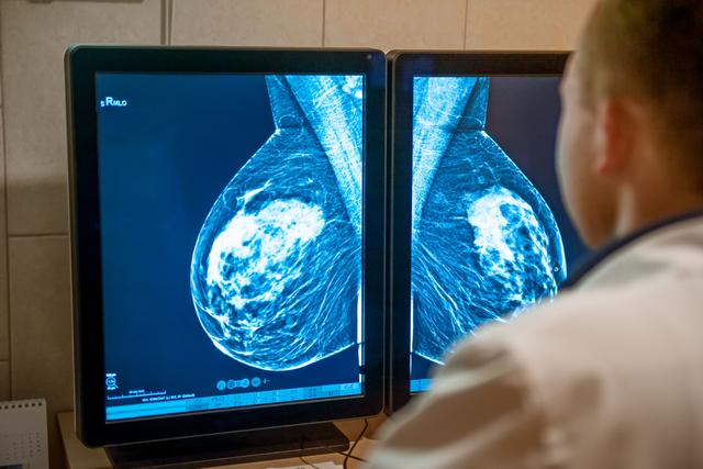 Family history criteria used to predict breast cancer genetic risk variants | Image Credit: © okrasiuk - © okrasiuk - stock.adobe.com.