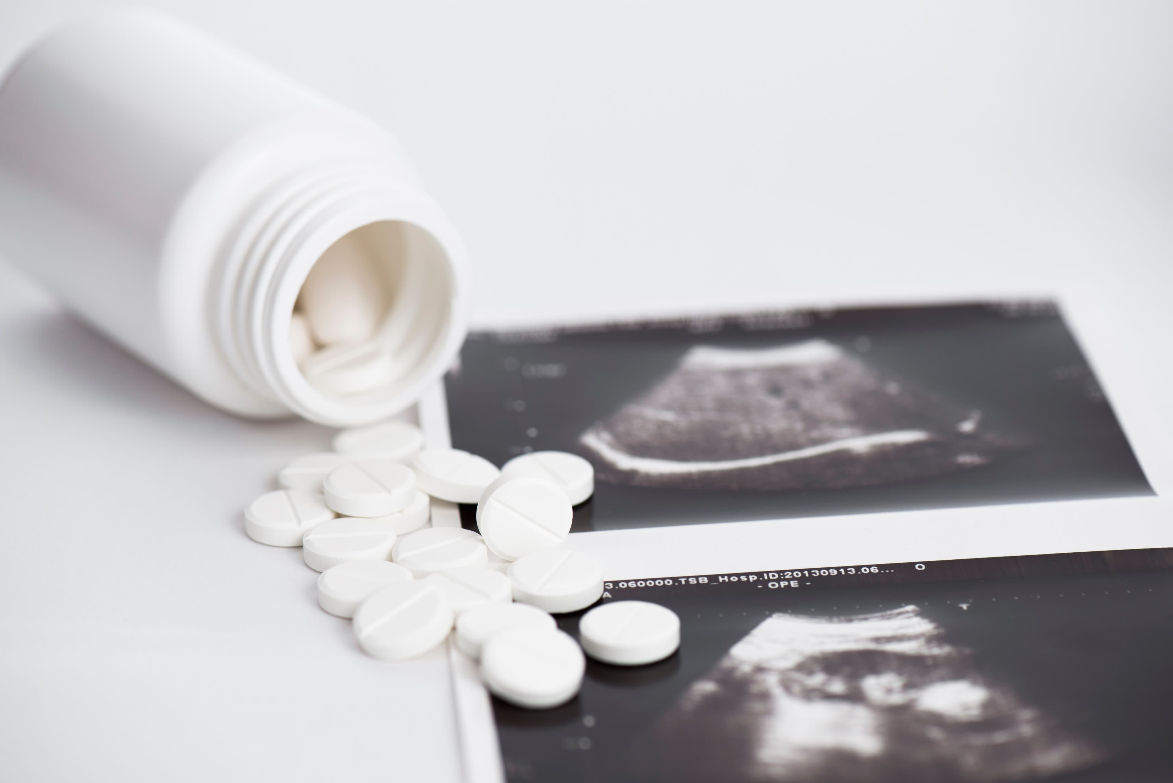 Safety and efficacy from very early medication abortion reported | Image Credit: © ivanko80 - © ivanko80 - stock.adobe.com.